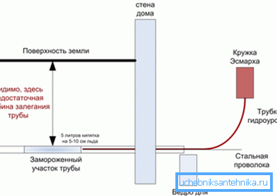 Схема использования кружки Эсмарха Схема использования кружки Эсмарха